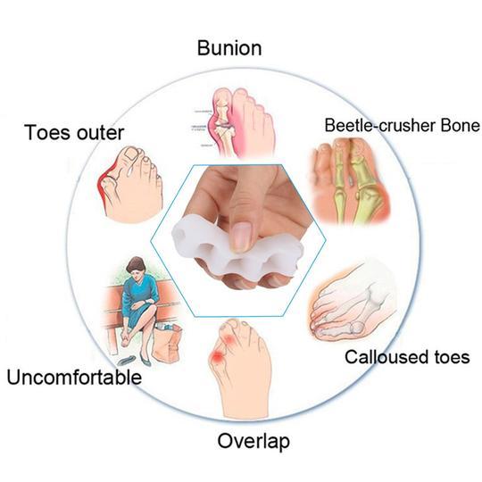 Orthopedic Toe Corrector